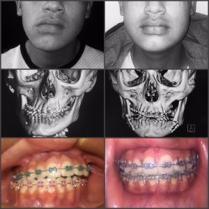 dientes